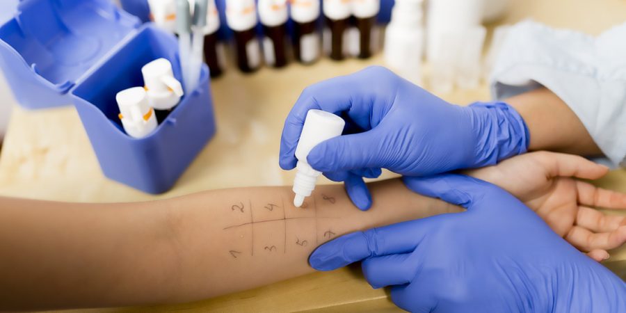 allergologia